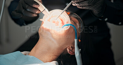 Buy stock photo Hands, dentist or patient with mouth procedure in dental clinic for help, veneers or medical surgery. Appointment, operation or woman in oral exam for dentistry, teeth whitening or cosmetic treatment