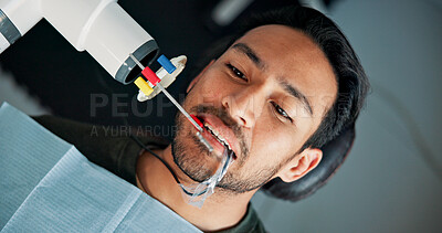 Buy stock photo Appointment, medical x ray and patient with dentist in office for checkup or mouth operation. Healthcare, hygiene or oral exam with dental professional and man at clinic for dentistry from above
