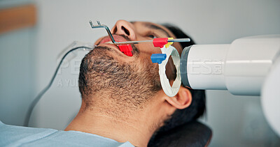 Buy stock photo Appointment, medical and x ray with patient in dentist office for checkup or mouth operation. Dental hygiene, healthcare or oral procedure with man at clinic for dentistry, exam or surgery closeup