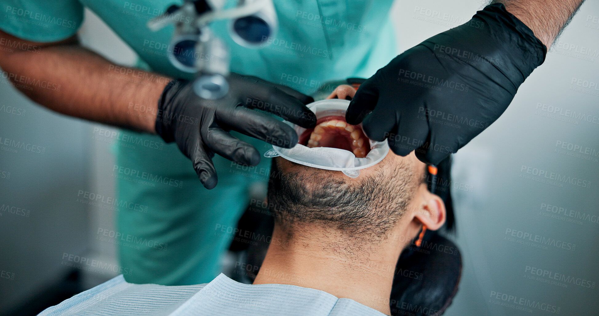 Buy stock photo Medical procedure, mouth and patient with dentist in office for checkup or oral operation. Dental hygiene, healthcare or tooth filling with medicine professional and man at clinic for dentistry