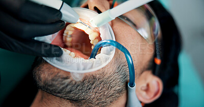 Buy stock photo Hands, man or mouth cleaning in dental clinic for tooth procedure, veneers and medical surgery. Appointment, operation or patient in oral exam for dentistry, teeth whitening and cosmetics treatment