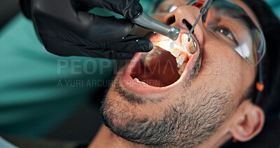 Buy stock photo Man, hands or dentist with drill for tartar, bacteria or germ removal at orthodontist. Closeup, male person or patient with surgeon cleaning plaque teeth for gum disease or tooth extraction at clinic