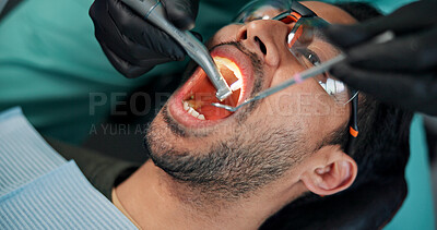 Buy stock photo Man, patient and dentist with mouth tools for cleaning, bacteria or germ removal at orthodontist. Male person, client or teeth surgeon with drill for tooth extraction, dental or oral care at clinic