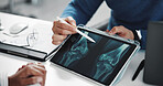 Doctor, patient and hands on tablet screen for knee x ray with injury, osteoporosis or tendon issue. People, pointing and talking in medical consultation for arthritis, feedback and clinic report