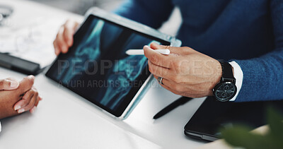 Buy stock photo Doctor, consulting or hands on tablet screen for x ray with knee injury, osteoporosis or tendon issue. People, patient and pointing to medical diagnosis for arthritis, feedback and healthcare report