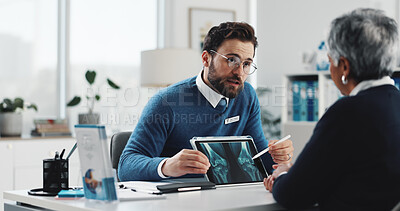 Buy stock photo Xray, tablet and doctor with old woman in office for consulting, osteoporosis or healthcare advice. Bone cancer treatment, medical and mri with senior patient in clinic for radiology and digital scan