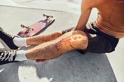 Buy stock photo Skateboard injury, pain and legs of man after fitness, exercise or sports workout in skatepark. Medical emergency, training accident problem and athlete skater anatomy of broken knee bone with blood
