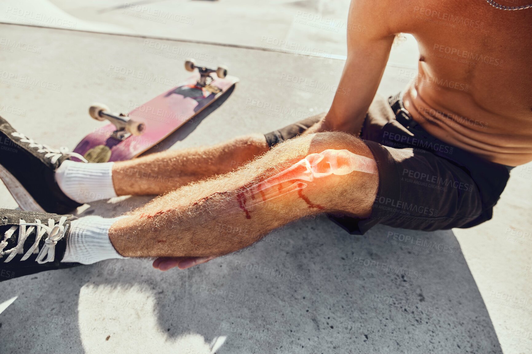 Buy stock photo Skateboard injury, pain and legs of man after fitness, exercise or sports workout in skatepark. Medical emergency, training accident problem and athlete skater anatomy of broken knee bone with blood