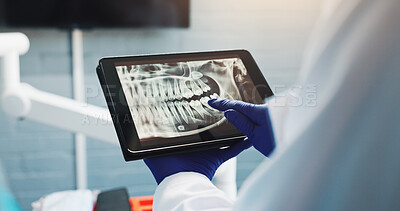 Buy stock photo Hands, dentist and tablet screen for x ray, tooth diagnosis or planning for healthcare treatment. Person, check and dental surgeon with digital tech for teeth structure, orthodontic procedure or help