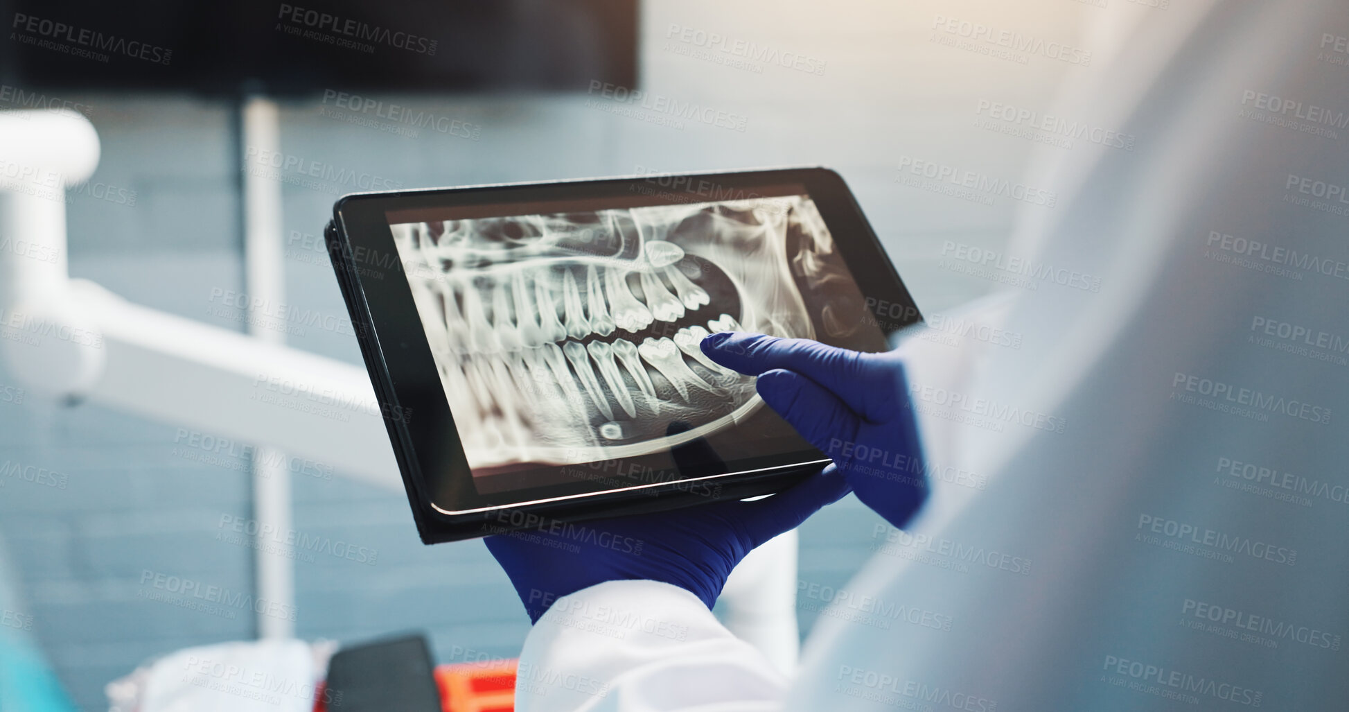 Buy stock photo Hands, dentist and tablet screen for x ray, tooth diagnosis or planning for healthcare treatment. Person, check and dental surgeon with digital tech for teeth structure, orthodontic procedure or help