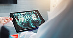 Hands, dental people and tablet screen for x ray, tooth diagnosis or planning for healthcare treatment. Dentist, check and surgeon with digital tech for teeth structure, orthodontic procedure or help