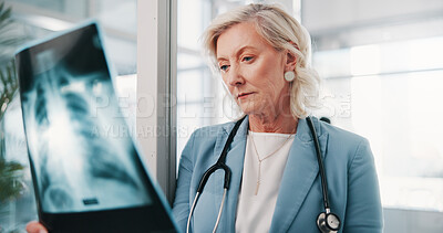 Buy stock photo Woman, doctor or inspection with x ray in hospital for examination, medical scan or test results. Mature, female person or healthcare professional with MRI radiograph for diagnosis in health clinic