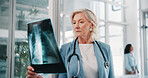 Woman, doctor or exam with x ray in hospital for medical inspection, CT scan or test results. Mature, female person or healthcare professional with MRI or radiograph for diagnosis in health clinic