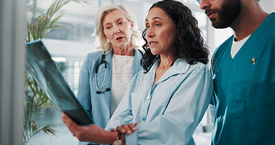Buy stock photo Doctors, x ray and people in hospital, teamwork or conversation with help, feedback or healthcare. Professional, medical group or employees in clinic, assessment of scan or cooperation with diagnosis