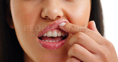 Buy stock photo Mouth, teeth check or woman in studio with gum disease, oral hygiene or treatment results. Dental care, medical condition and female person with gingivitis, tooth procedure or inflammation at dentist