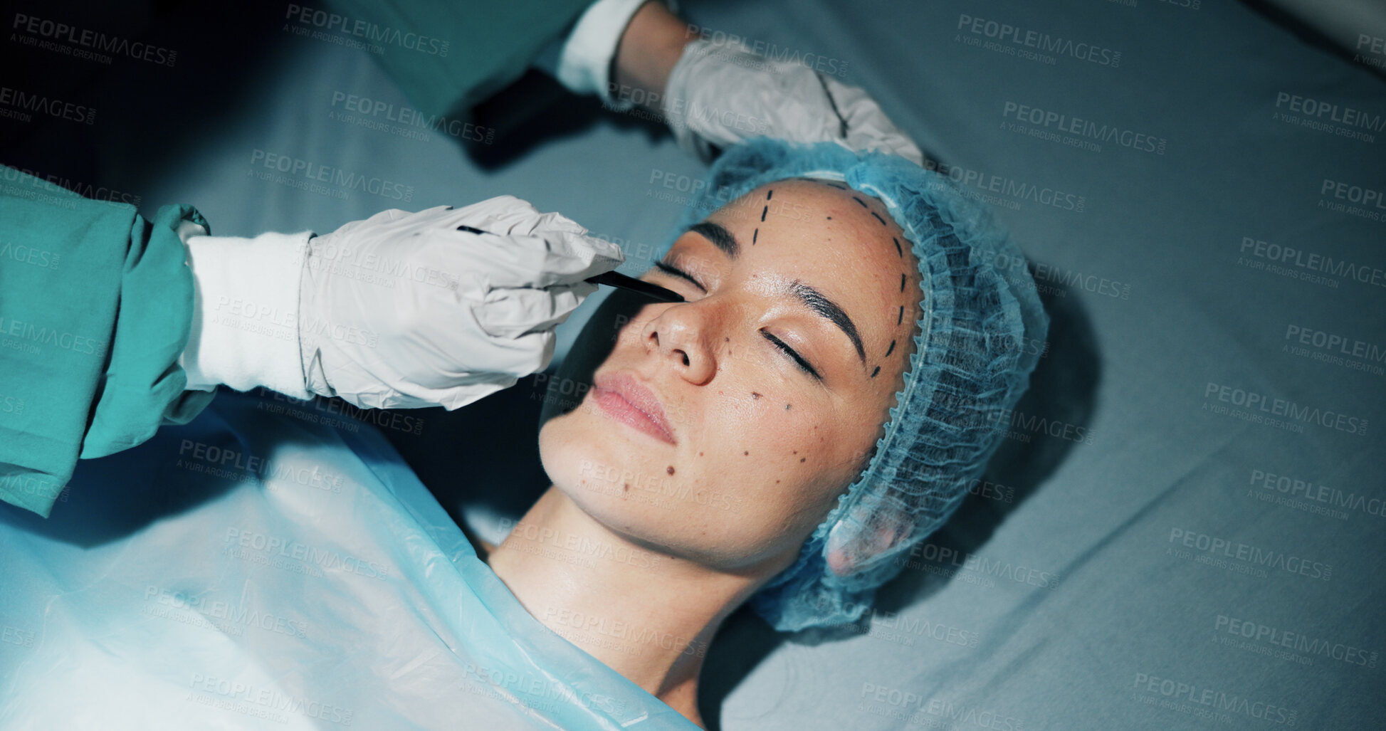 Buy stock photo Plastic surgery, woman and hands drawing on face for change, cosmetics and beauty with medical service. Doctor, patient and mark on skin, filler or collagen in process for transformation in hospital