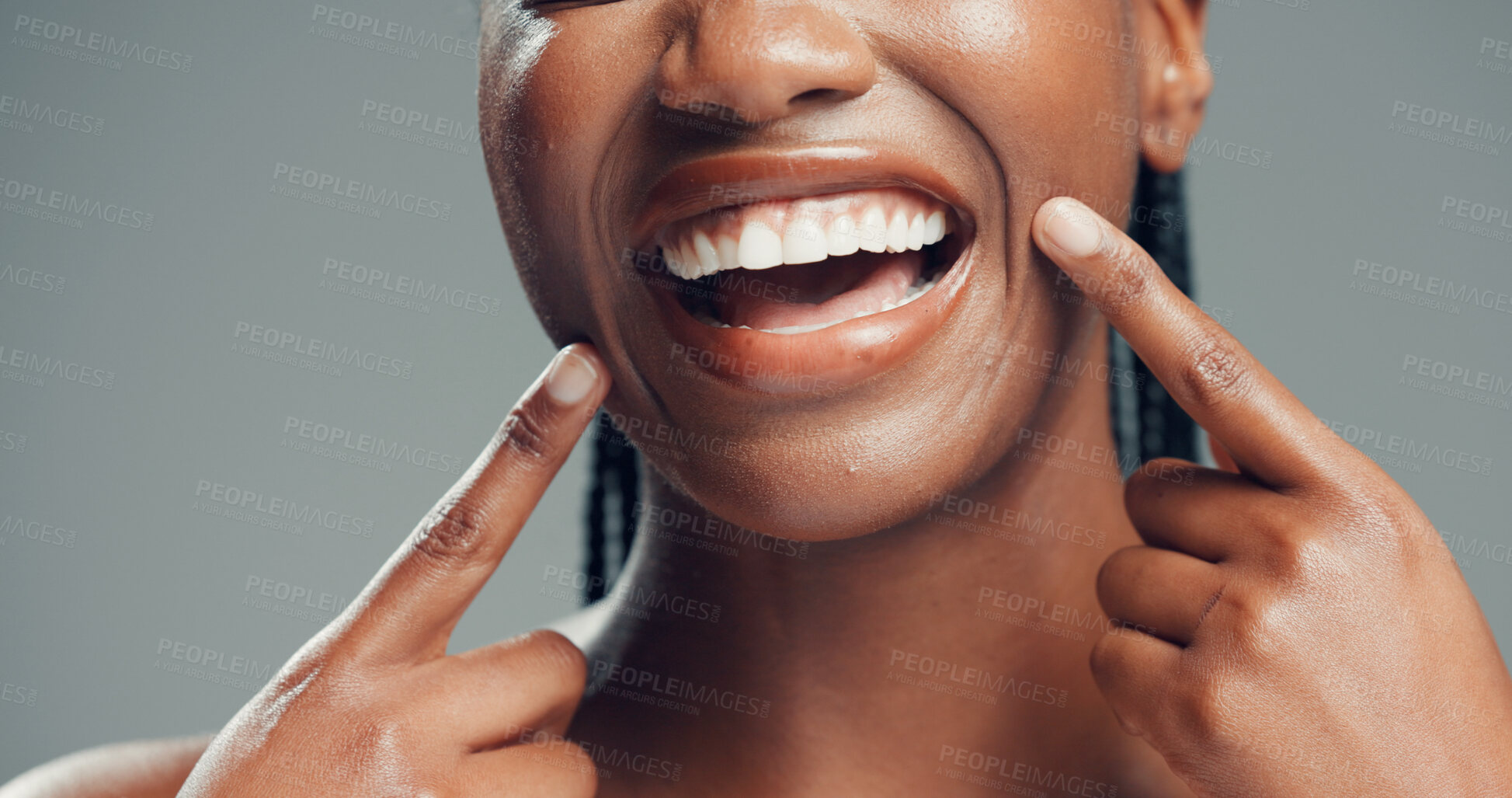 Buy stock photo Teeth, dental wellness and woman point at mouth for oral health, fresh breath and gum care. Hands, excited person and tooth whitening for orthodontics, veneers or lips in studio on gray background
