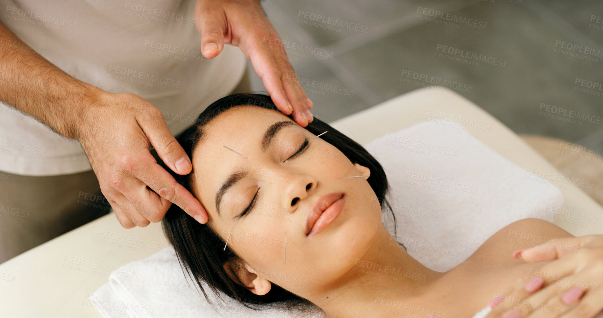 Buy stock photo Therapist, woman and face acupuncture in spa for beauty, stress relief and traditional medicine. Above, person and sleeping at wellness resort with needle for skincare, ancient treatment and healing.