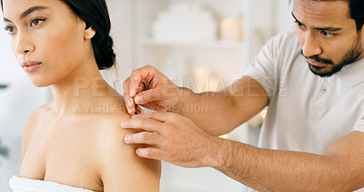Buy stock photo Therapist, woman and shoulder in spa with acupuncture, stress relief and traditional Chinese medicine. Expert, person and wellness at retreat with needle, ancient healing method and pain management.