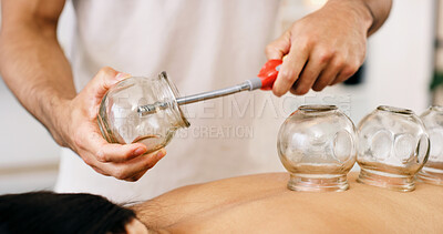 Buy stock photo Hands, lighter and cupping therapy for back pain, relax and healing for muscle blood flow benefits. Therapist, holistic spa and person on bed for wellness, health or resort with deep tissue massage