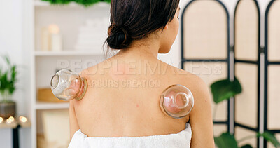 Buy stock photo Spa, back of woman or cupping therapy with suction for blood circulation, muscle tension or healing. Cups, female person or ancient medicine at wellness center for pain relief and deep tissue massage