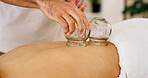Hands, spa and cupping therapy for back pain, healing and relax for muscle blood flow and benefits. Therapist, person and patient on bed for wellness, health and resort with deep tissue massage