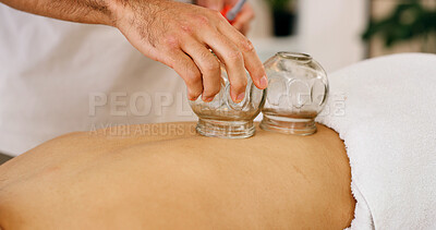 Buy stock photo Hands, spa and cupping therapy for back pain, healing and relax for muscle blood flow and benefits. Therapist, person and patient on bed for wellness, health and resort with deep tissue massage