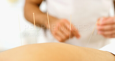 Buy stock photo Back, person and needle for acupuncture at spa for muscle tension, natural pain relief and healing. Closeup, people and traditional medicine for physical therapy, joint inflammation and dry needling