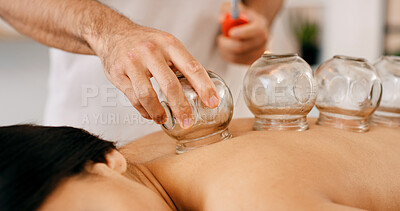 Buy stock photo Hands, glass and cupping therapy for back pain, health and healing for muscle blood flow benefits. Therapist, holistic spa and person on bed for wellness, relax or resort with deep tissue massage