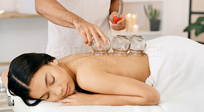 Buy stock photo Woman, glass and cupping therapy for back pain, relax and healing for muscle blood flow and benefits. Therapist, holistic spa and person on bed for wellness, health or resort with deep tissue massage