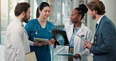 Buy stock photo Xray, discussion and team of doctors with nurse in hospital for medical diagnosis in collaboration. Radiography image, tablet and group of healthcare employees with treatment planning in clinic