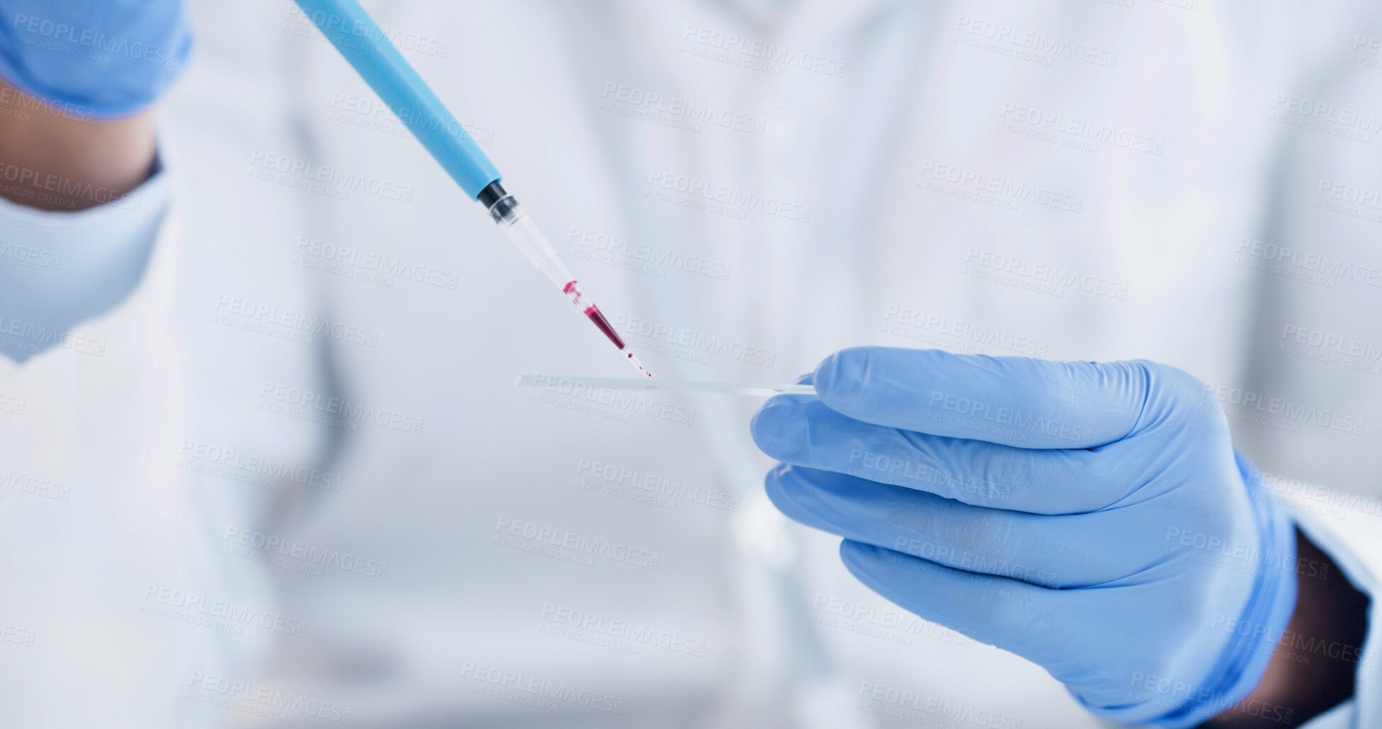 Buy stock photo Science, blood sample and dropper with hands in laboratory for medical research, vaccine formula and test. Healthcare study, analysis and chemical solution with person in clinic for dna extraction