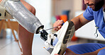Physiotherapist, hands or leg with prosthetic for adjustment, balance or mobility control in clinic. Therapist, foot or person with a disability for synthetic aid, muscle rehabilitation or recovery