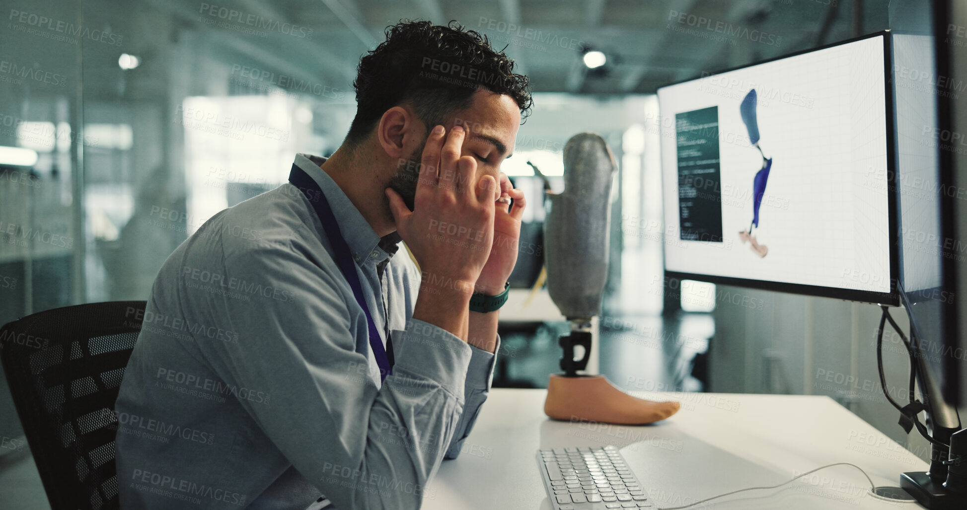 Buy stock photo Prosthetic leg, headache and man in lab, computer screen and bionic anatomy innovation. Scientist, programmer or person in workplace, robotics or migraine with burnout. tension or blue light exposure