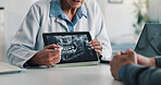 Person, hands or doctor with tablet for x ray exam, test results or medical procedure in hospital. Healthcare worker, employee or showing patient with technology, screen or display for CT scan or MRI