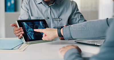 Buy stock photo Doctor, hands and tablet screen with x ray in consultation, healthcare diagnosis or review results. Tech, people and patient with bones, radiology scan and point with medical assessment in clinic