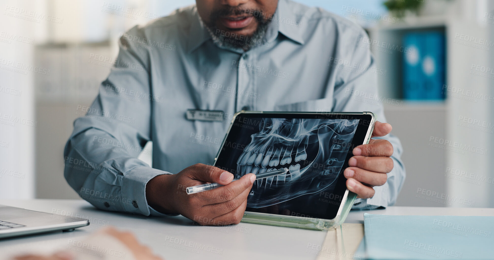 Buy stock photo Dentist, hands and tablet screen with teeth x ray, healthcare or cavity detection for diagnosis. Tech, man and dental scan  for radiology results, medical consultation and orthodontics in hospital