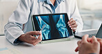 Tablet screen, consulting and doctor hands with xray for knee injury, diagnostic results or help. Patient, woman or tech with CT scan review for joint damage, bone marrow transplant or clinic checkup