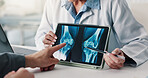 Tablet screen, doctor and patient hands with xray for knee injury, surgery planning or diagnosis. Health, people and tech with CT scan review for joint dislocation, assess damage and clinic follow up