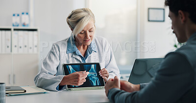 Buy stock photo Tablet screen, xray and doctor with man in hospital with consultation for medical diagnosis. Discussion, digital technology and healthcare worker with male patient for radiology scan in clinic.