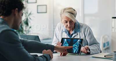 Buy stock photo Tablet screen, xray and doctor with man in clinic with consultation for medical diagnosis. Discussion, digital technology and healthcare worker with male patient for radiology scan in hospital.