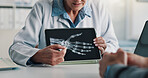 Doctor, consulting and tablet screen with hand xray for bone fracture, orthopedic care or diagnosis. Medical, patient or professional with CT scan for joint health, treatment plan or clinic follow up