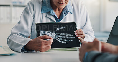 Buy stock photo Doctor, consulting and tablet screen with hand xray for bone fracture, orthopedic care or diagnosis. Medical, patient or professional with CT scan for joint health, treatment plan or clinic follow up