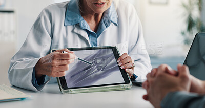 Buy stock photo Tablet screen, consulting and doctor hands with scan for knee injury, orthopedic surgery or results. Health, woman and tech with patient xray for joint damage, rehabilitation and hospital follow up