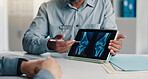 Tablet screen, doctor or patient hands with scan for knee injury, surgery planning or diagnosis. Health, people or app with xray review for joint dislocation, arthritis evaluation or clinic follow up