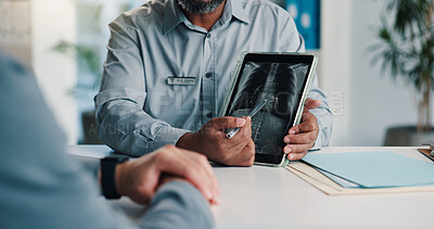 Buy stock photo Tablet screen, checkup and doctor hands with xray for chest examination, lung disease or diagnosis. Cardiology, people or tech with patient scan for respiratory infection, tumor or hospital follow up