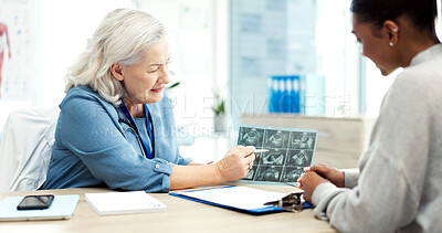 Buy stock photo Doctor, ultrasound and pregnant woman in consultation, talking and fertility report for ivf progress. Gynecology, pregnancy news or people in hospital, scan for growth and family planning with advice