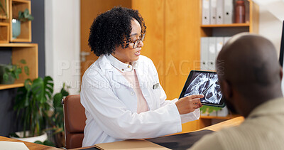 Buy stock photo Consulting, tablet screen and xray with doctor of patient in office for feedback or MRI review. Advice, radiology and results with medical professional speaking to person in hospital for diagnosis