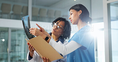 Buy stock photo Doctor, nurse and review xray in hospital, advice and feedback for medical treatment with specialist. Woman, surgeon and radiology scan for healthcare, guide or help for diagnosis at clinic flare