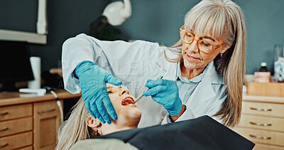 Buy stock photo Checkup, dentist and woman in clinic for teeth cleaning, extraction or tooth exam procedure. Consultation, oral hygiene and orthodontist with patient for root canal or dental implant in office.